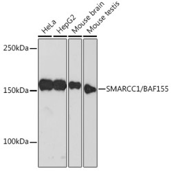 [KO Validated] SMARCC1/BAF155 Rabbit mAb