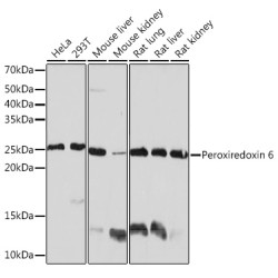 Peroxiredoxin 6 Rabbit mAb