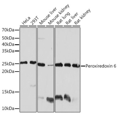 Peroxiredoxin 6 Rabbit mAb