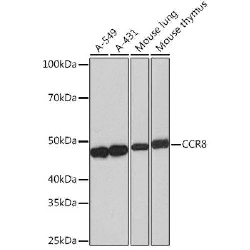 CCR8 Rabbit mAb