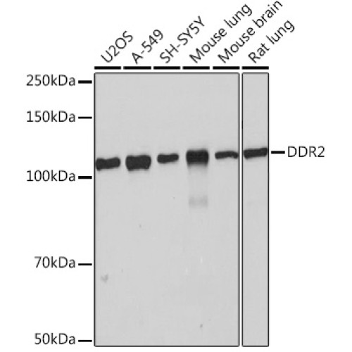 DDR2 Rabbit mAb