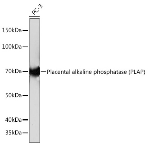 Placental alkaline phosphatase (PLAP) Rabbit mAb