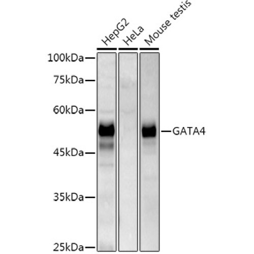 GATA4 Rabbit mAb