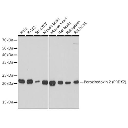 Peroxiredoxin 2 (PRDX2) Rabbit mAb