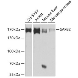 SAFB2 Rabbit pAb