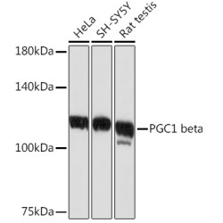 PGC1 beta Rabbit mAb