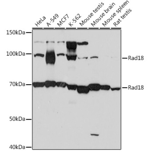 Rad18 Rabbit mAb