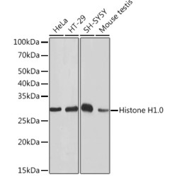 Histone H1.0 Rabbit mAb