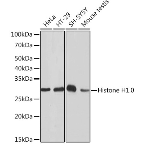 Histone H1.0 Rabbit mAb