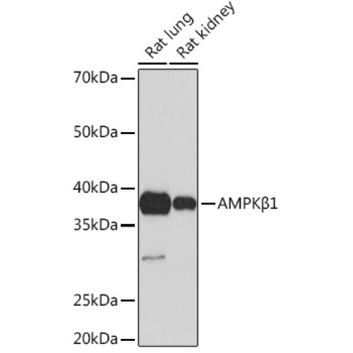 AMPKβ1 Rabbit mAb