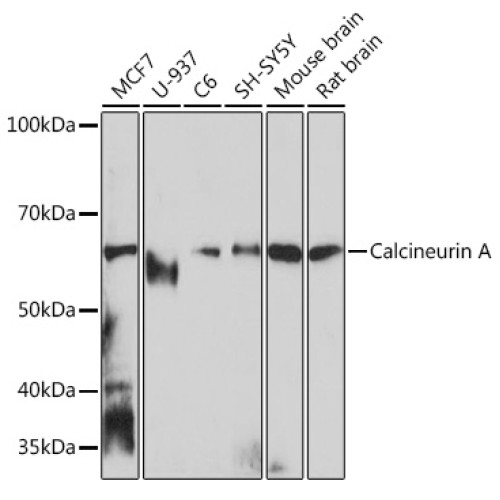 Calcineurin A Rabbit mAb