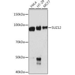 SUZ12 Rabbit mAb