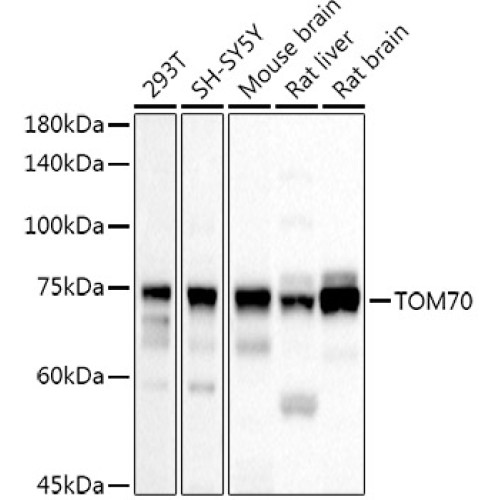 TOM70 Rabbit pAb