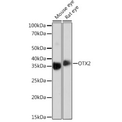 OTX2 Rabbit mAb