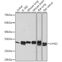 LYVE1 Rabbit mAb