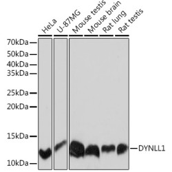 DYNLL1 Rabbit mAb
