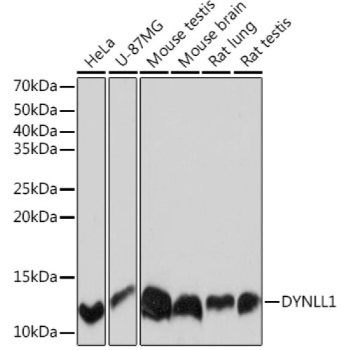 DYNLL1 Rabbit mAb