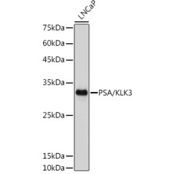 PSA/KLK3 Rabbit mAb