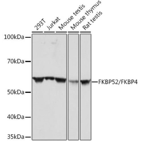 FKBP52/FKBP4 Rabbit mAb