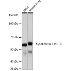 Cytokeratin 7 (KRT7) Rabbit mAb