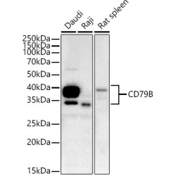 CD79B Rabbit mAb