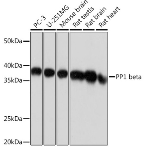 PP1 beta Rabbit mAb