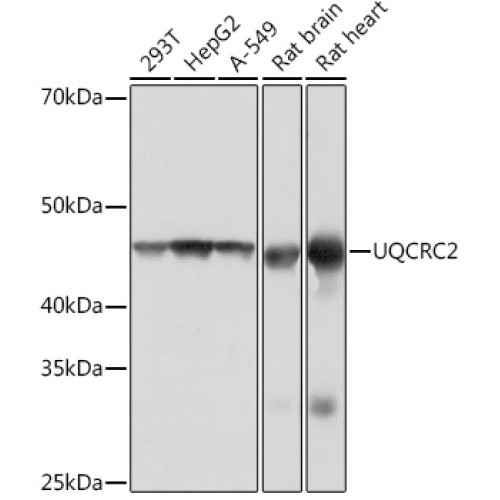 UQCRC2 Rabbit mAb