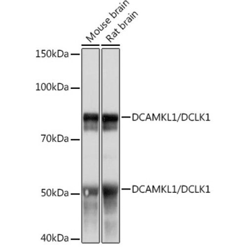 DCAMKL1/DCLK1 Rabbit mAb