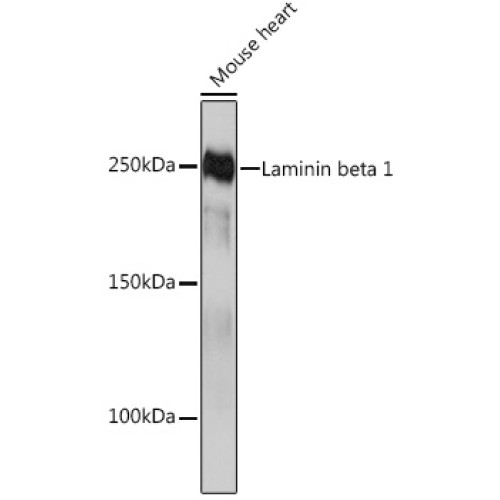 Laminin beta 1 Rabbit mAb