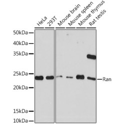 Ran Rabbit mAb