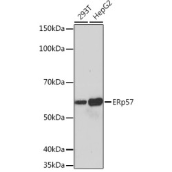 ERp57 Rabbit mAb