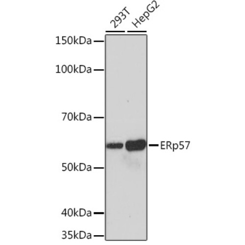 ERp57 Rabbit mAb