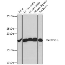 Stathmin 1 Rabbit mAb