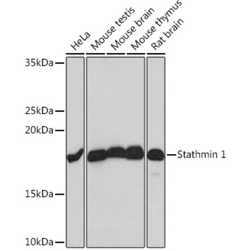 Stathmin 1 Rabbit mAb