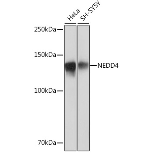 NEDD4 Rabbit mAb