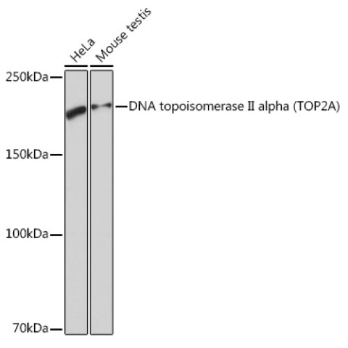 DNA topoisomerase II alpha (TOP2A) Rabbit mAb