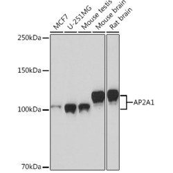 AP2A1 Rabbit mAb