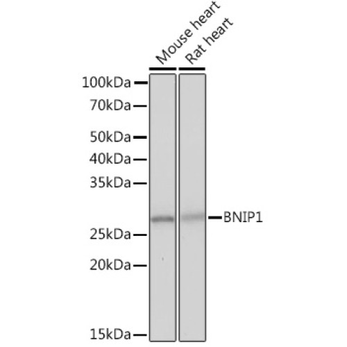 BNIP1 Rabbit mAb