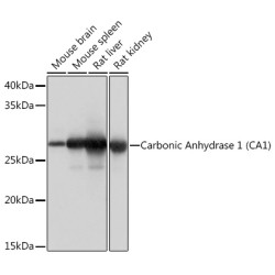Carbonic Anhydrase 1 (CA1) Rabbit mAb