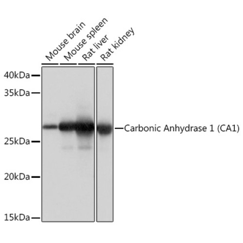 Carbonic Anhydrase 1 (CA1) Rabbit mAb