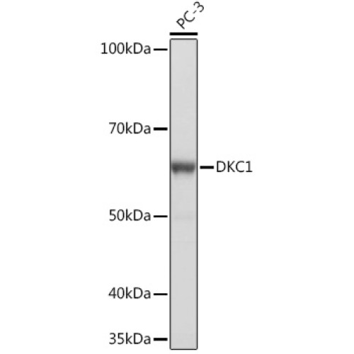 DKC1 Rabbit mAb