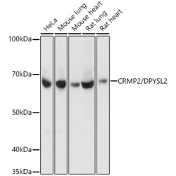 [KO Validated] CRMP2/DPYSL2 Rabbit mAb