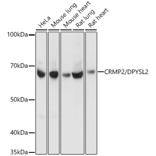 [KO Validated] CRMP2/DPYSL2 Rabbit mAb