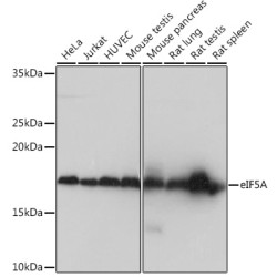 eIF5A Rabbit mAb