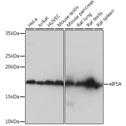 eIF5A Rabbit mAb
