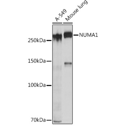 NUMA1 Rabbit mAb