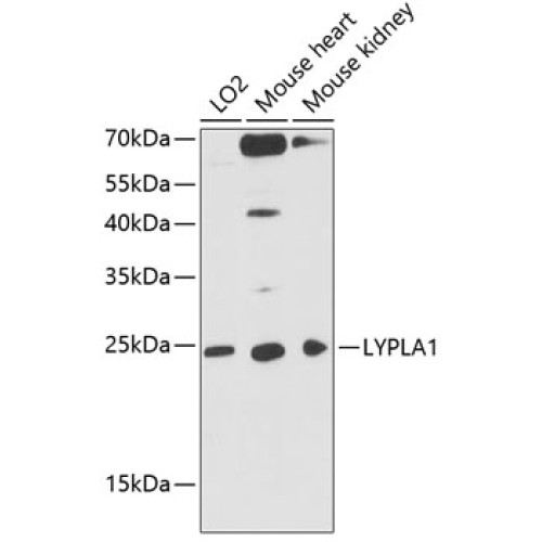 LYPLA1 Rabbit pAb