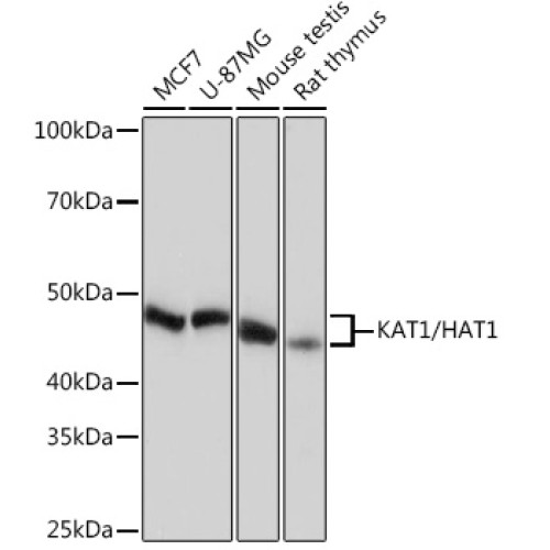 [KO Validated] KAT1/HAT1 Rabbit mAb