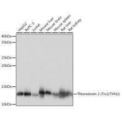 Thioredoxin 2 (Trx2/TXN2) Rabbit mAb