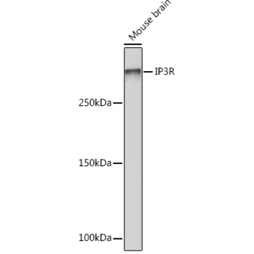 IP3R Rabbit mAb